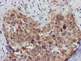 FBXO21 Antibody (clone OTI5H4)