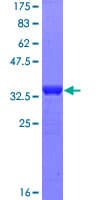 Human MAP3K2 / MEKK2 Protein (Recombinant GST, N-terminus)