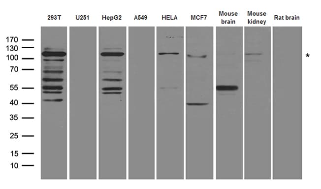 HIRA Antibody