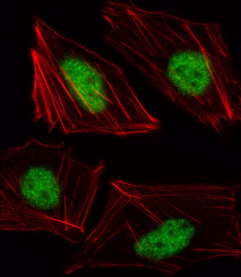TBX15 Antibody (aa47-73)