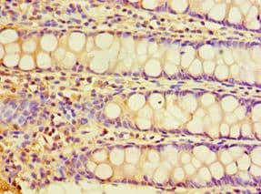 CHRFAM7A Antibody (aa1-150)