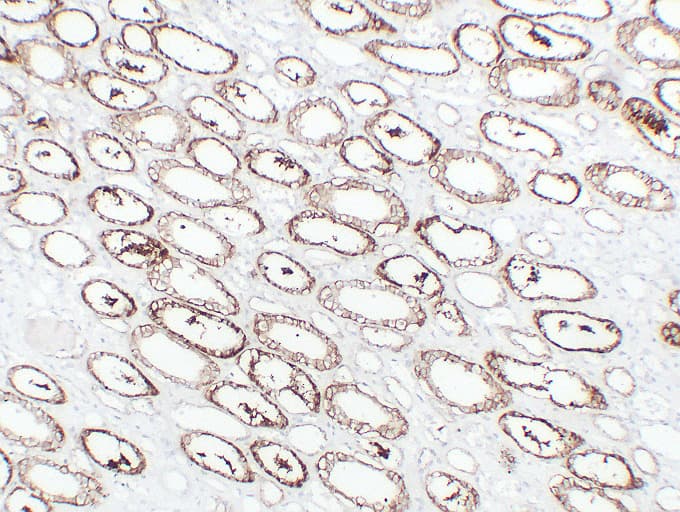 CDH16 / Cadherin 16 Antibody (clone ABT-CDH16)