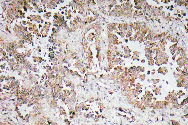 SNCAIP / Synphilin 1 Antibody (aa797-846)