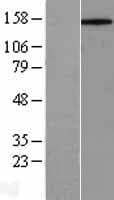 CD45 / LCA Protein (Over-Expression Lysate Myc-DDK (Flag))