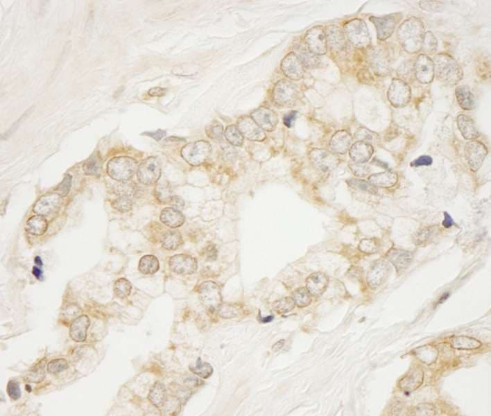Polyclonal Rabbit anti-Human ARFGEF1 Antibody (aa1800-C-term, IHC)