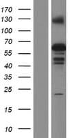 ZSCAN5B Protein (Over-Expression Lysate Myc-DDK (Flag))