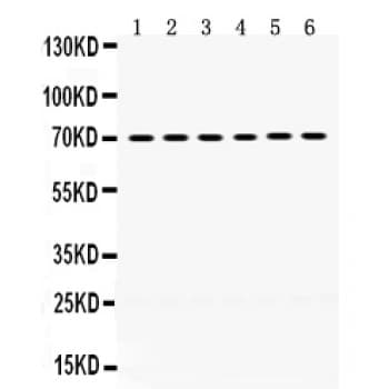 PDPK1 / PDK1 Antibody (aa524-556)