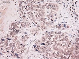 NTF4 / Neurotrophin 4 Antibody (clone OTI2E8)