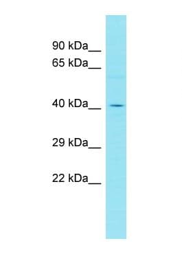 Polyclonal Rabbit anti-Human FAM153B Antibody (aa315-364, WB)