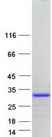 Human CT45A4 Protein (Recombinant Myc-DDK (Flag))