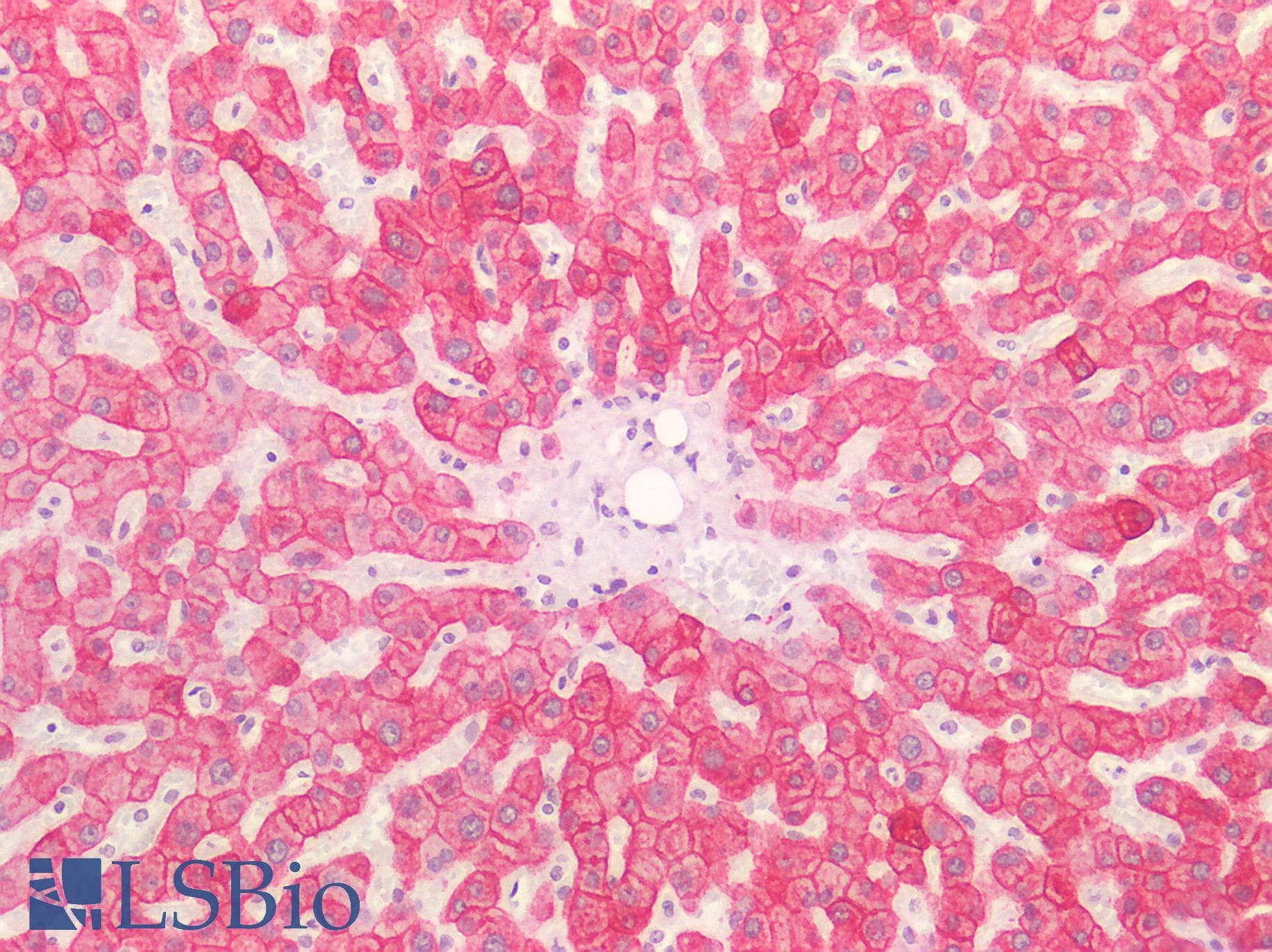 PathPlus™ Monoclonal Mouse anti-Human Basic Cytokeratin AE3 Antibody (clone AE-3, Concentrated, IHC, WB)