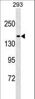 NUP188 Antibody (aa132-160)