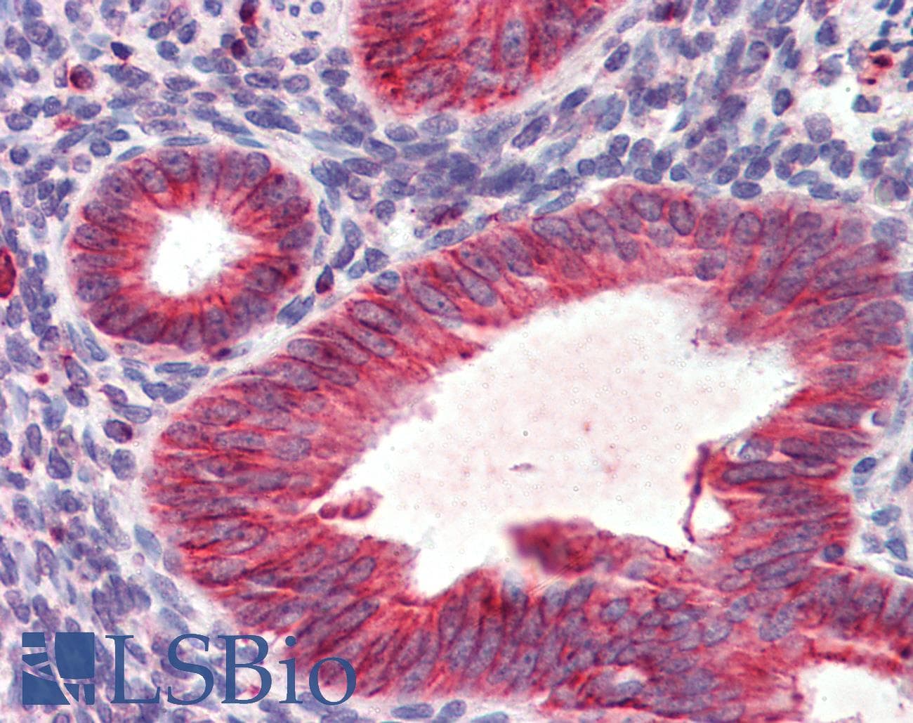 IHC-plus™ ALCAM / CD166 Antibody (clone 10F1G12)