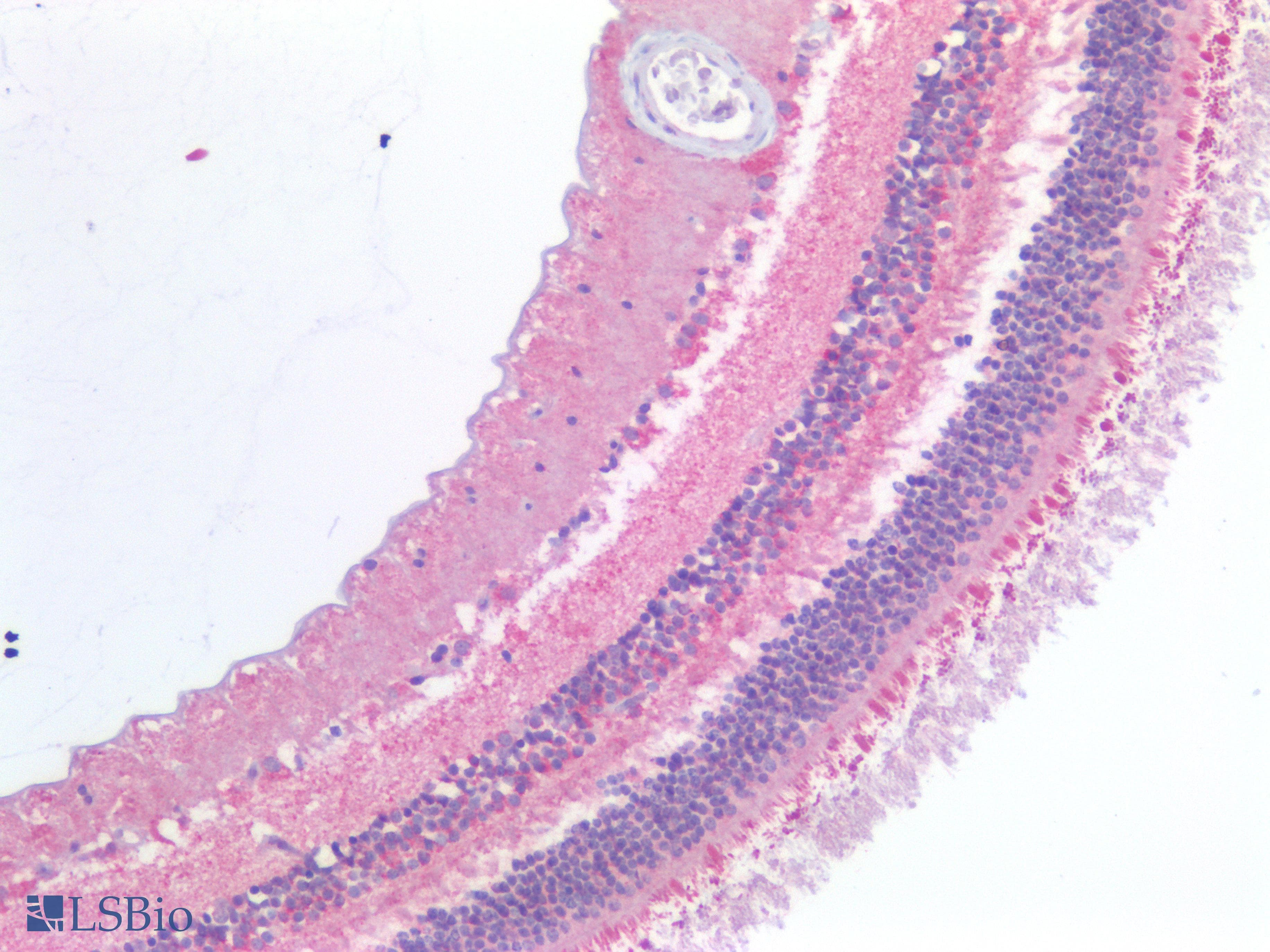 PathPlus™ Polyclonal Rabbit anti-Human ABCA4 Antibody (IHC)