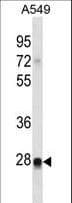 RIT2 / RIN Antibody (aa41-69)