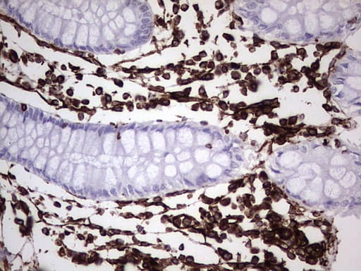 Vimentin Antibody (aa210-466, clone UMAB159)
