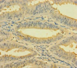 RPL26L1 Antibody