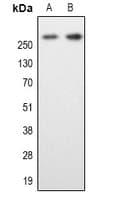 Polyclonal Rabbit anti-Human MAP2 Antibody (N-Terminus, IHC, WB)