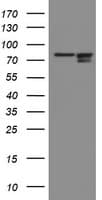 Paraplegin / SPG7 Antibody (clone OTI1C12)