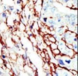 EPHA7 / EPH Receptor A7 Antibody (aa896-925)