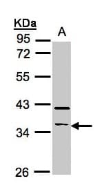 Polyclonal Rabbit anti-Human RASSF2 Antibody (aa1-293, WB)