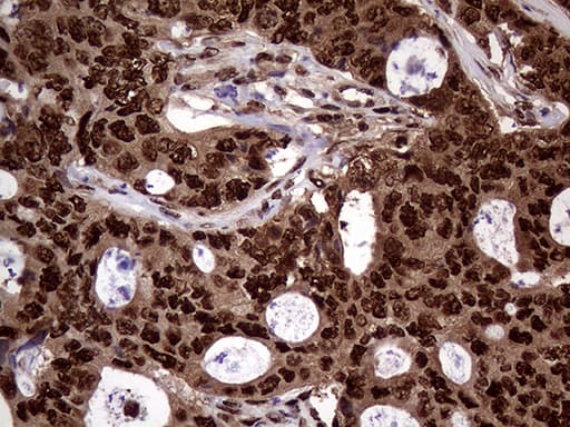TALDO1 / Transaldolase 1 Antibody (clone OTI1E5, Carrier-free)
