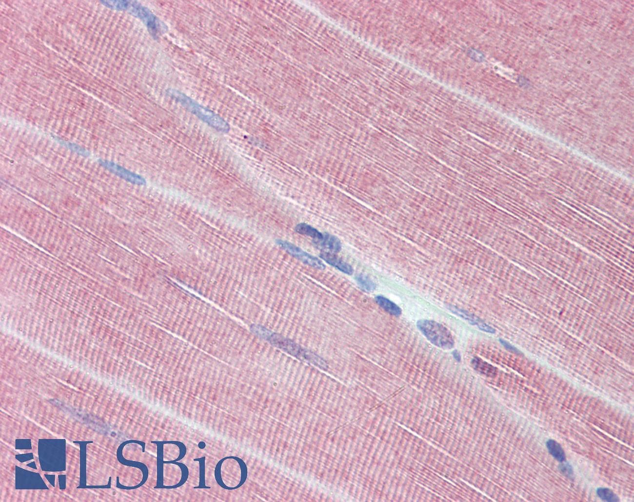 IHC-plus™ Polyclonal Goat anti-Human PPP1R12A / MYPT1 Antibody (IHC, IF)