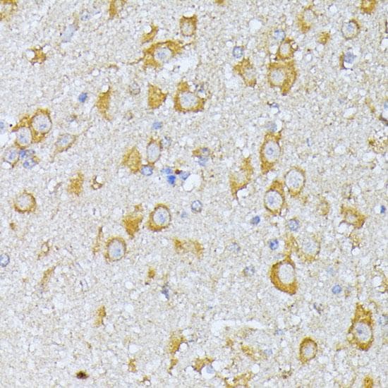 Polyclonal Rabbit anti-Human EIF2B2 Antibody (IHC, IF)