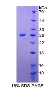 Rat TACR2 / NK2R Protein (Recombinant His-T7)