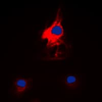 Polyclonal Rabbit anti-Human HARS Antibody (C-Terminus, IHC, IF, WB)