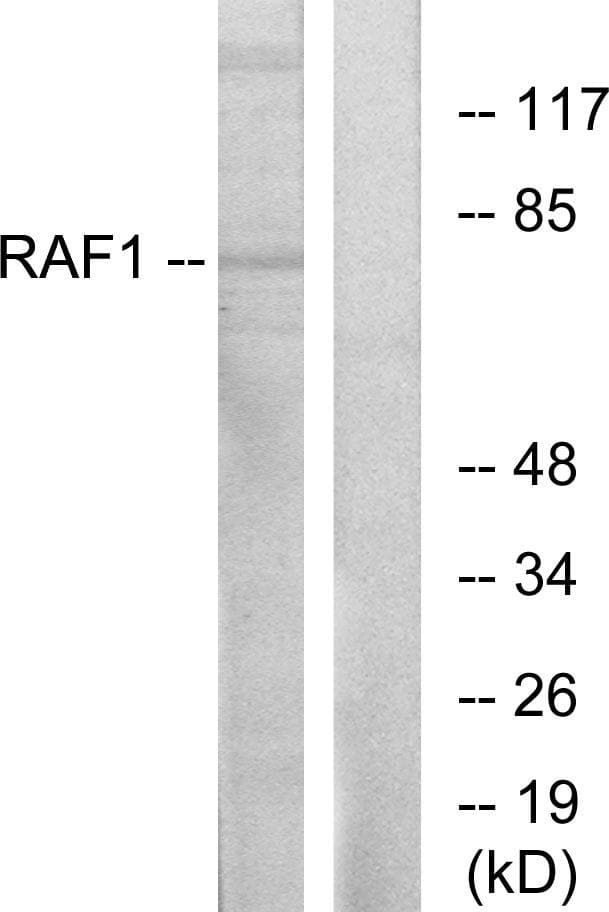 Polyclonal Rabbit anti-Human RAF1 / RAF Antibody (p341, WB)