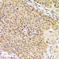 UBAC1 / KPC2 Antibody