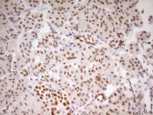 NR2C2 / TAK1 Antibody (aa1-241, clone OTI1F3)
