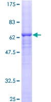 Human SDR9C1 / BDH1 Protein (Recombinant GST)