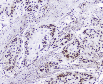 HMGN2 Antibody