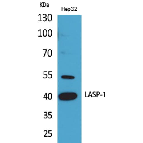 Polyclonal Rabbit anti-Human LASP1 Antibody (Internal, WB)