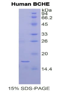 Human BCHE / Cholinesterase Protein (Recombinant His)