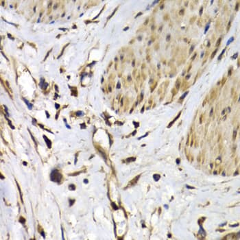 Polyclonal Rabbit anti-Human ISG15 Antibody (IHC, WB)