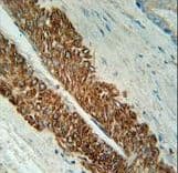 STEAP2 Antibody (aa229-258)