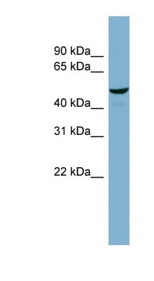 RTCB / C22orf28 Antibody (aa359-408)