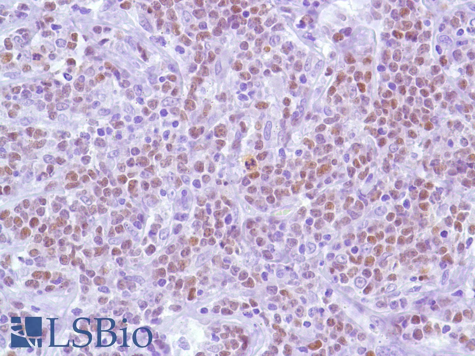 Monoclonal Rabbit anti-Human BCL6 Antibody (clone SP155, C-Terminus, IHC)
