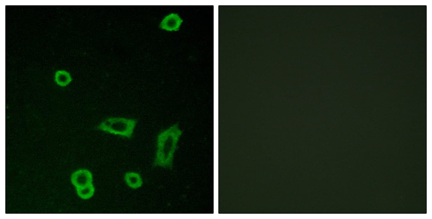 GPR50 Antibody (aa301-350)
