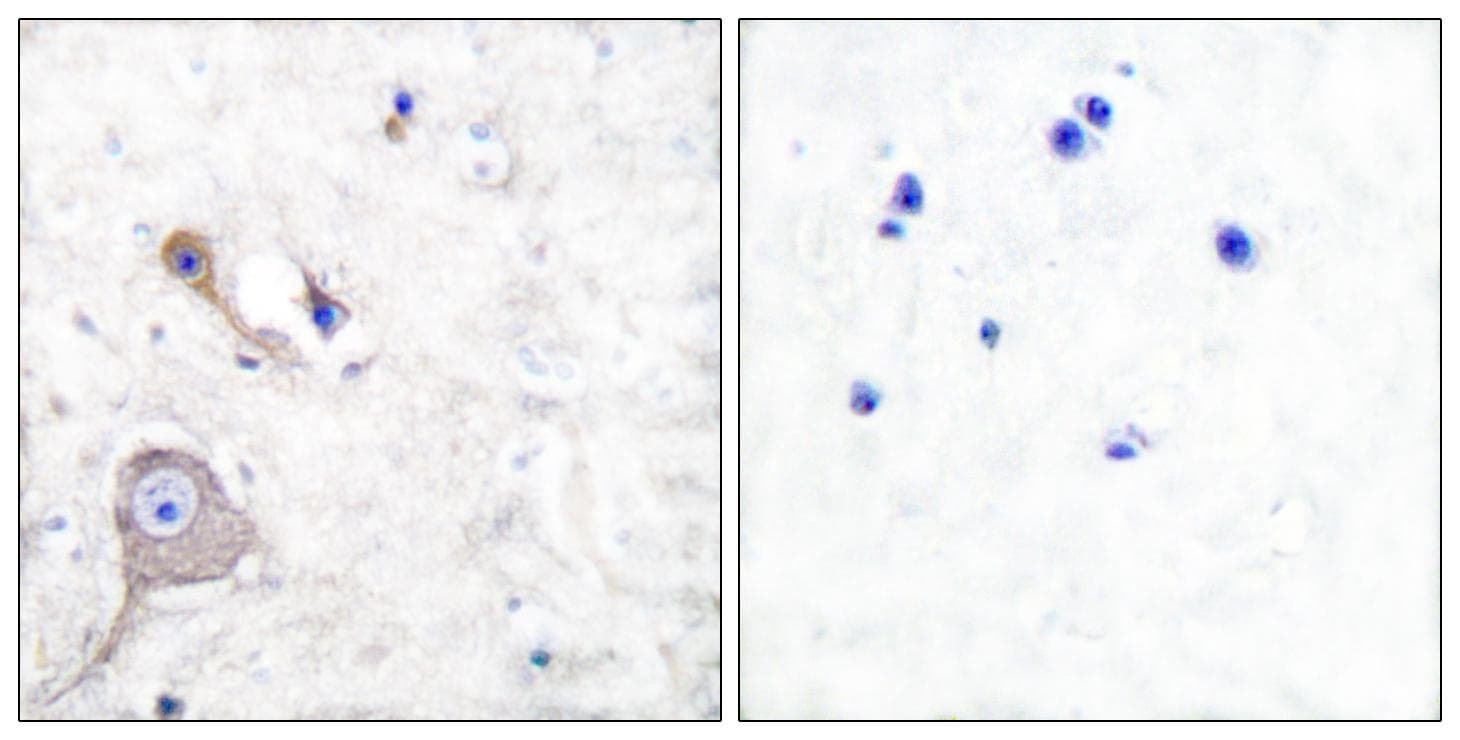 Polyclonal Rabbit anti-Human S100 Protein Antibody (IHC, IF, WB)