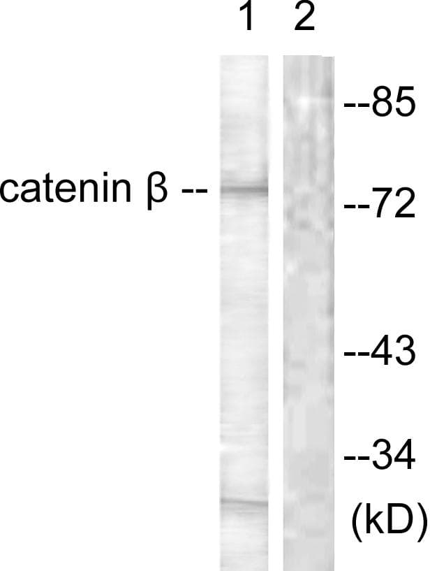 CTNNB1 / Beta Catenin Antibody (p654)