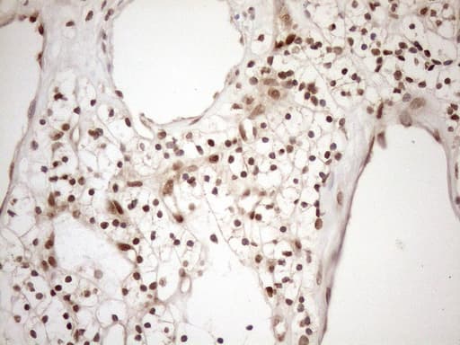 MGMT Antibody (clone OTI10H9)