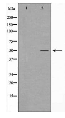 KRT16 / CK16 / Cytokeratin 16 Antibody
