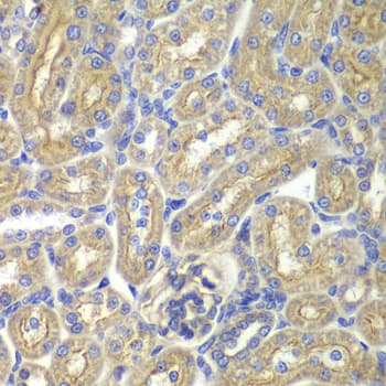 BAIAP2 / IRSP53 Antibody