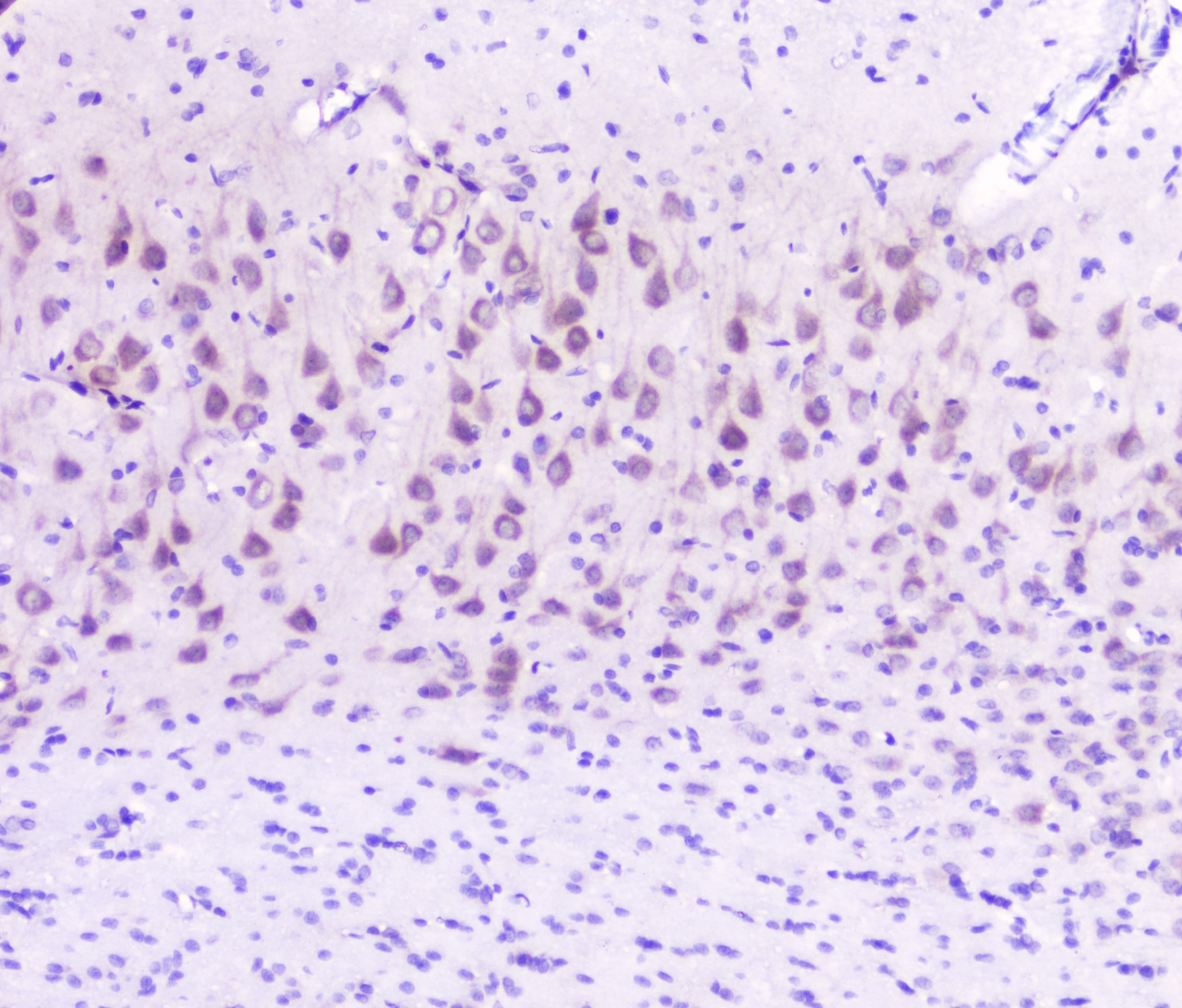 Polyclonal Rabbit anti-Human GOLPH3 Antibody (IHC, WB)