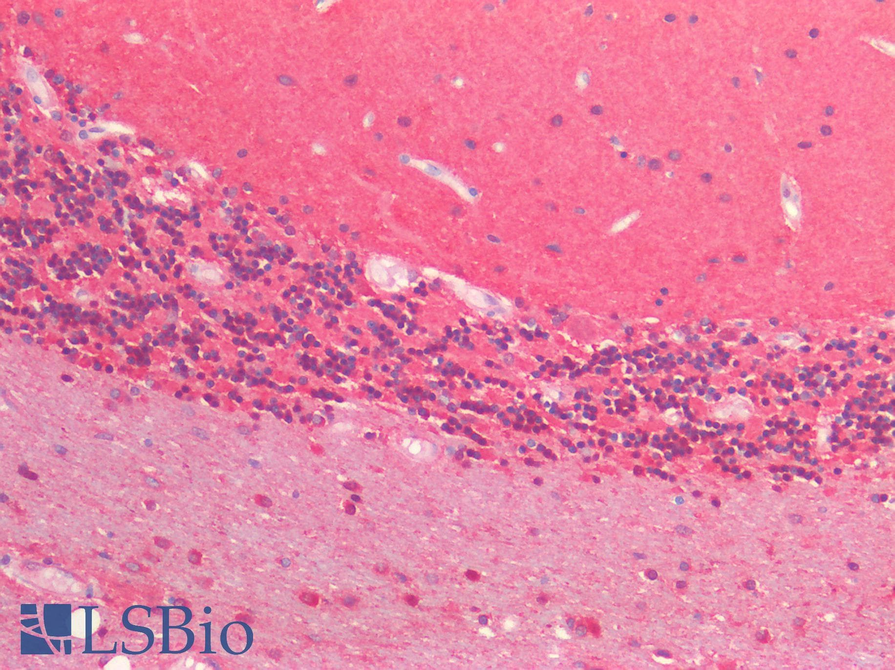 IHC-plus™ Proenkephalin / PENK Antibody