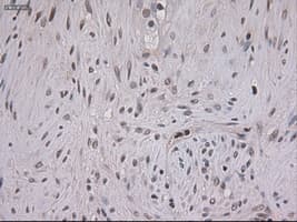 STAT3 Antibody (clone OTI21E7)